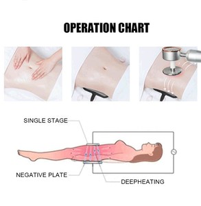 อุปกรณ์นวดสลายไขมันกระชับสัดส่วนมีโซลูชันควบคุมอุณหภูมิที่เชื่อถือได้ - Product Image 5