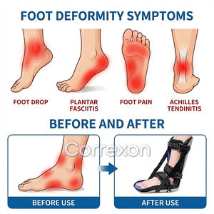 ISO CE 인증 정형외과 AFO 발목 보조기 재활 보행 부츠 의료기기 - Product Image 2