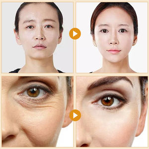 Pronto Para Enviar Private Label 2 Peças Set Golden Firm Skin Facial Serum Essence Protein Line Lifting Face Colágeno Threads - Product Image 5