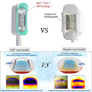 <span class=keywords><strong>Appareil</strong></span> de Cryo-sculpture à 360° pour la gestion du poids par congélation des graisses, Cavitation 40K, RF Visage et Corps, avec poignée Grande et Moyenne Taille - Product Image 6