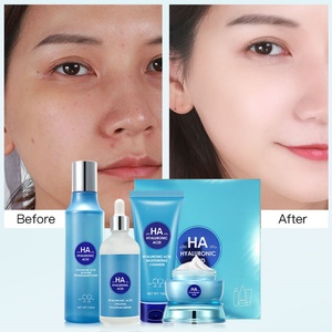 Produits de soin de la peau à l'acide hyaluronique, crème pour le visage, sérum hydratant, crème anti-âge, ensemble de soins de la peau à étiquette privée - Product Image 2