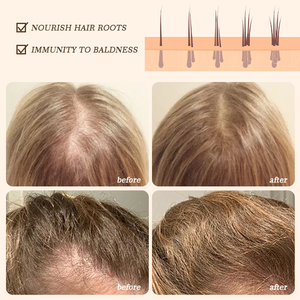 Polygonum Multiflorum Shampoo oscurante riduzione dei capelli grigiore radice dei capelli nutriente naturale senza solfato Bar Shampoo per capelli - Product Image 3