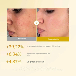 Sérum Rénovateur à l'<span class=keywords><strong>Acide</strong></span> Kojique et au Curcuma 250ml Éclaircissant Exfoliant Atténue les Taches Brunes Unifie le Teint Doux Niacinamide Anti-Âge - Product Image 4