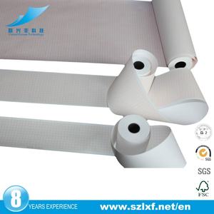 Rollo de Papel Térmico para ECG de Una Sola Capa de Alta Calidad, Consumibles Médicos en China (50 mm x 30 m) - Product Image 4