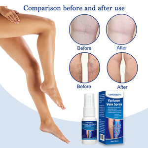 Spray para Várices de Venta Caliente, Alivia el Dolor de las Venas Varicosas, 30 ml - Product Image 3