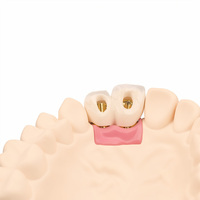 Couronne dentaire en zircone de haute qualité pour cliniques et laboratoires |   Durable, fabriqué avec précision pour des performances fiables