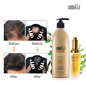 Armalla – formule à base de plantes au gingembre, <span class=keywords><strong>traitement</strong></span> du cuir chevelu, réduit la <span class=keywords><strong>chute</strong></span> des cheveux, réparation biologique, shampoing <span class=keywords><strong>Anti</strong></span>-<span class=keywords><strong>chute</strong></span> des cheveux - Product Image 4