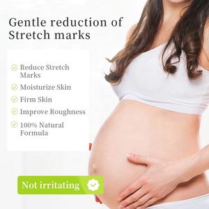 OEM-Crema de eliminación de marcas de estiramiento, sello personalizado de 100ml, mango orgánico natural, crema para el vientre y el embarazo - Product Image 5