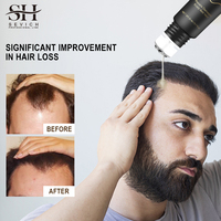 Sérum de repousse des cheveux Vente d'usine OEM Roll-On Anti perte de cheveux Sérum d'huile de croissance des cheveux organique pour le cuir chevelu