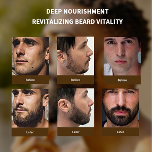 Huile Essentielle pour Soins de la <span class=keywords><strong>Barbe</strong></span> Homme : Lissante, Hydratante, Nourrissante pour la Peau, Favorise la Croissance de la <span class=keywords><strong>Barbe</strong></span>, Améliore l'Éclat et la Densité pour une <span class=keywords><strong>Barbe</strong></span> Éclatante - Product Image 4