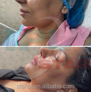 Appareil de thérapie au laser endo 1470 nm Body Tite Diode, minimal invasif, 980 nm double ondes pour le lifting du visage, la beauté du cou, les soins personnels - Product Image 6