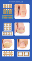 Autocollants de correction des ongles des pieds sans colle et indolores, patchs de soin pour la cicatrisation des ongles