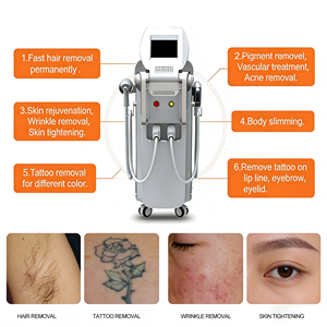 Máquina Láser de Diodo IPL de Alta Intensidad de 808nm 4 en 1 para Resultados Rápidos - Product Image 6
