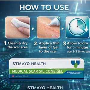 Gel para Remoção de Cicatrizes de Acne, Queimaduras, Estrias e Cicatrizes de Cesárea para Mulheres, Homens e Crianças - Reparação de Pele com Silicone OEM - Product Image 5
