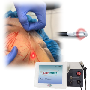 Sợi nâng 980nm 1470nm cổ papada Lipo endolaser Fibra quang phẫu thuật lipolysis chất béo hòa tan hút mỡ sculptra máy - Product Image 1