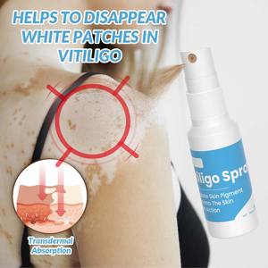 Traitement du <span class=keywords><strong>vitiligo</strong></span> à base de plantes 30ml Vente en gros Soins de la peau Spray dissolvant de taches blanches - Product Image 3