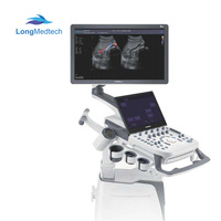 Ecógrafo a Color Sonoscape P25 4D con Carro, Monitor LED a Color de Alta Resolución de 21.5 Pulgadas, Imágenes de Elastografía por Compresión
