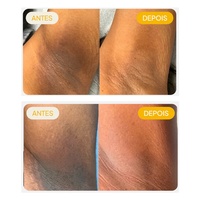 Crème Correctrice Anti-Taches Puissante ADEUS 10X pour le Visage et le Corps, Traitement de l'Hyperpigmentation, 100g, Durée de Conservation de 3 Ans, Marque Privée