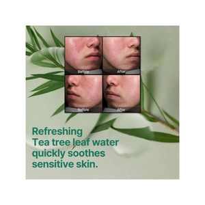 Crema Facial Exfoliante Aha Para Piel Normal a Mixta, Eliminación Suave de Células Muertas y Sebo con Crema - Product Image 6