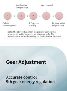 Novo instrumento portátil remoção mancha elétrica Cautery máquina Mole remoção dispositivo melanina tatuagem remoção caneta - Product Image 6