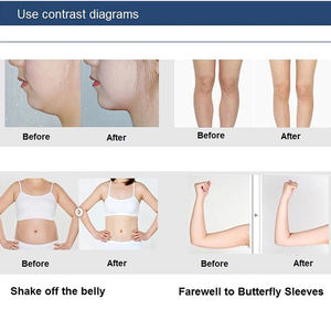 Rodillo Facial 3D en Forma de Y con Rotación de 360 Grados, Masajeador Facial Manual para Áreas Específicas - Product Image 4