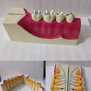 โมเดลฟัน Dt Dental รุ่น Mx-2 แบบถอดประกอบได้ พร้อมแม่เหล็ก สำหรับการเรียนการสอน ขนาด 11*4*5.3 ซม. สำหรับทำความสะอาดและอุดฟัน อุปกรณ์ทันตกรรม - Product Image 2