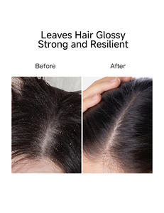 Shampoo liquide rafraîchissant anti-croûtes et anti-chute de <span class=keywords><strong>cheveux</strong></span>, contrôle du sébum - Product Image 6