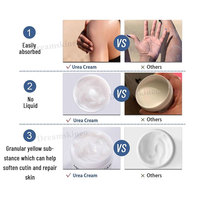 Marque privée 40% urée crème pour le visage blanchissant apaisant réparateur niacinamide hydratant dissolvant de peau doux Anti fissures exfoliant