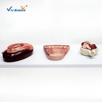 Modelo Anatómico de Glómerulo Renal con Ampliación, PVC, Ciencia Médica