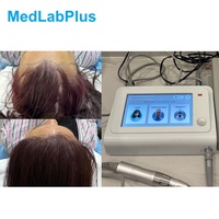 Machine de transplantation capillaire MedLabPlus, extraction de cheveux longs sans rasage, plusieurs tailles de punches, 1880xg RCF, système FUE intelligent portable