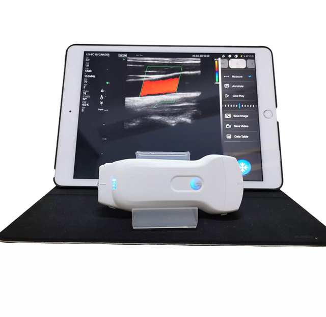 MC27 Most Welcomed Wifi&usb Ultrasound Probe Scanner Double Heads with Convex, Linear and Cardiac for Human or Vet