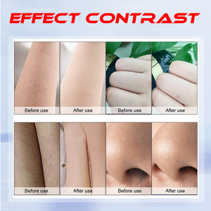 <span class=keywords><strong>Épilation</strong></span> au <span class=keywords><strong>laser</strong></span> diode professionnelle 808nm 755nm 1064nm Appareil pour tous les types de cheveux Refroidissement - Product Image 2