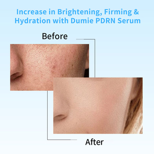 Nhãn hiệu riêng cá hồi <span class=keywords><strong>DNA</strong></span> pdrn chống lão hóa huyết thanh cá hồi trứng <span class=keywords><strong>DNA</strong></span> Ampoule Collagen Glutathione Niacinamide 6 axit hyaluronic - Product Image 6