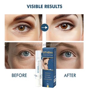 OTVENA - Crema Contorno de <span class=keywords><strong>Ojos</strong></span> Orgánica <span class=keywords><strong>Antiarrugas</strong></span> de Marca Reconocida, Reafirmante e Hidratante para las Bolsas y Arrugas Debajo de los <span class=keywords><strong>Ojos</strong></span> - Product Image 4