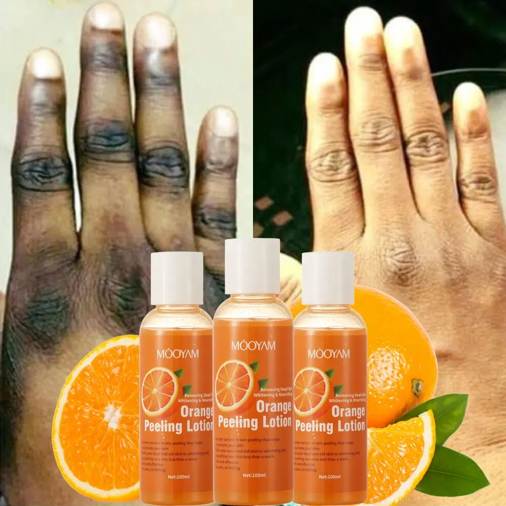 Siêu Hiệu Quả Orange Peeling Lotion Loại Bỏ Da Chết Lightens Điểm Tối Nhược Điểm Glowing Da Mới Làm Trắng Lotion