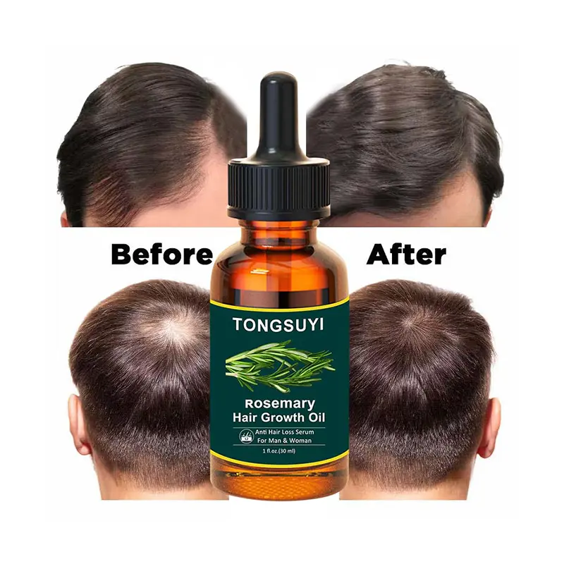 Private Label Best Hair Regrowth Oil Anti Hair loss Treatment Organic Ginger Hair Growth Oil Serum For Men Woman