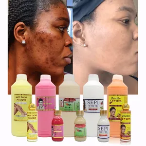 Organic Dark Spot Correcting Glow Melasma Treatment Serum Lightening Bleaching Whitening Skin Care Serum for Black Skin