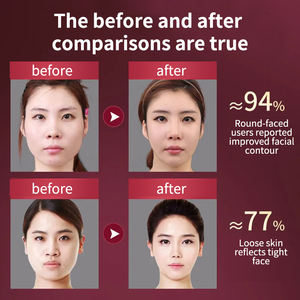 Appareil de massage facial raffermissant en V pour le lifting du visage et l'élimination du double menton, 12 modes, rechargeable par USB - Product Image 3