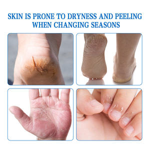 Stick hydratant pour les mains et les pieds, hydratation intense, apaise les talons fissurés, baume réparateur pour les pieds - Product Image 4