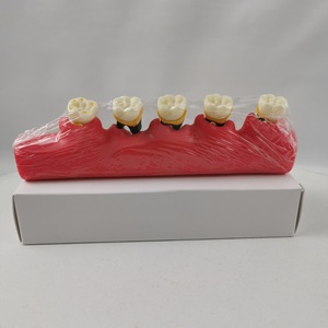 Modèle dentaire de classification parodontale M4010, modèle anatomique en silicone médical pour l'enseignement dentaire - Product Image 3