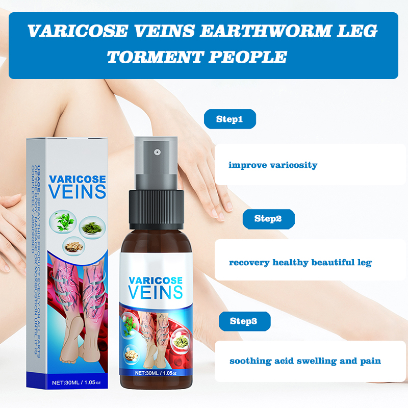 hot sell varicose veins remover treatment spray for veins earthworm leg torment 30ml