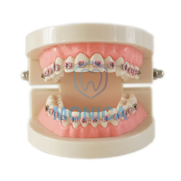 Modelo de estudio de enseñanza de dientes dentales conjunto completo modelo de Ortodoncia con soporte de Metal/soporte dental modelo estándar de dentaduras postizas