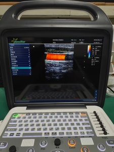 Appareil d'échographie Doppler couleur numérique complet DMU77 avec écran LCD de 15 pouces, instrument de diagnostic médical portable - Product Image 4