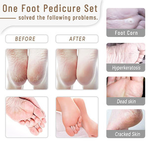 Stainless Steel Pedicure Set Customizable Manicure <b>Nail</b> Care Grooming <b>Kit</b> for Salon Spa and Home Use - Product Image 5