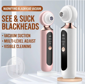 Appareil électrique de nettoyage des pores avec caméra pour soins de la peau, fabriqué en usine OEM - Product Image 6