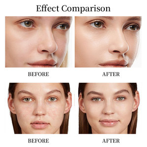 Sérum Huile Anti-Âge et Anti-Rides à la Vitamine E Bicolore avec Logo Personnalisé 20ml – Éclaircissant, Blanchissant, Raffermissant Visage et Corps, Base de Maquillage - Product Image 5