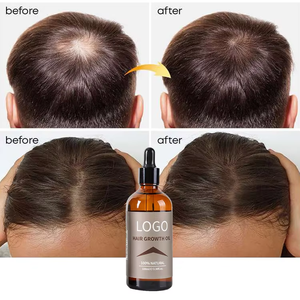 Масло для быстрого роста волос - Product Image 1