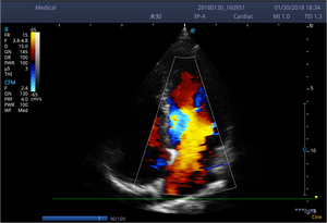 Échographe vétérinaire portable Sonoscape E3V E3 Doppler couleur avec imagerie microvasculaire SR Flow pour animaux de grande et petite taille - Product Image 5