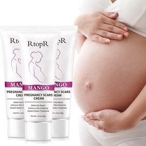 <span class=keywords><strong>Crema</strong></span> RtopR al Mango <span class=keywords><strong>per</strong></span> il Trattamento Efficace di Smagliature e <span class=keywords><strong>Cicatrici</strong></span> da Gravidanza <span class=keywords><strong>per</strong></span> la Cura della Pelle del Corpo - Product Image 1