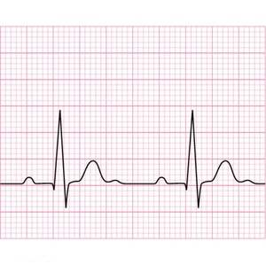 Giấy Điện Tâm Đồ <span class=keywords><strong>Nihon</strong></span> <span class=keywords><strong>Kohden</strong></span> Ekg Y Tế Gấp Z Bệnh Viện Bột Gỗ Giá Bán Sỉ - Product Image 5